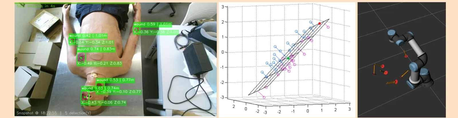 YOLO wound detection, the deprojected depth patch, and the fitted surface normal in RViz