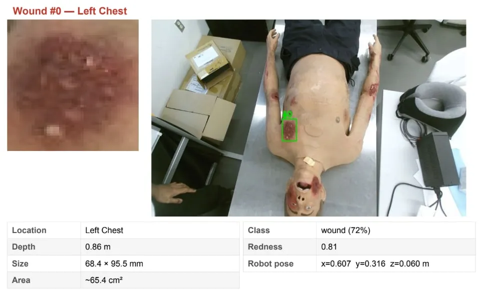 Generated clinical report entry with wound crop, location, depth, size, redness and robot pose