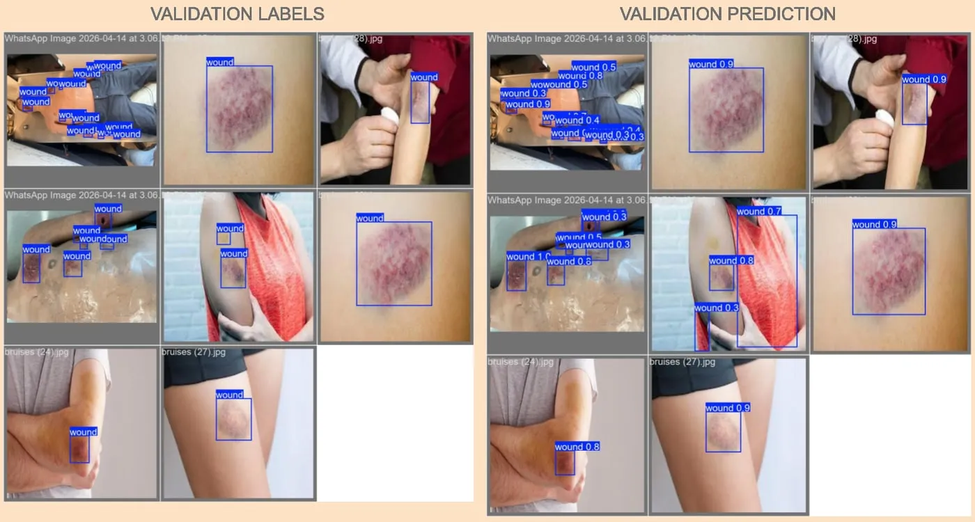 Grid of validation images comparing ground-truth wound labels against model predictions